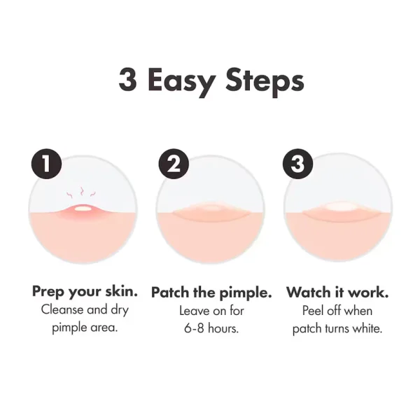 Pure O Fresh Pimple Patch 36 Patches